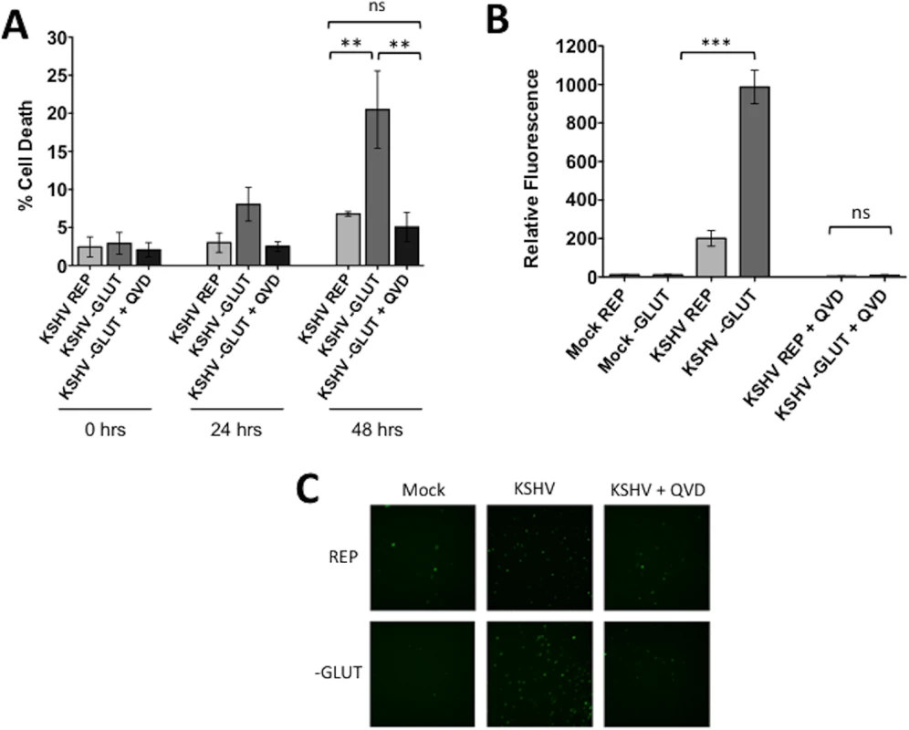 Glutamine starvation leads to apoptosis of KSHV-infected endothelial cells.