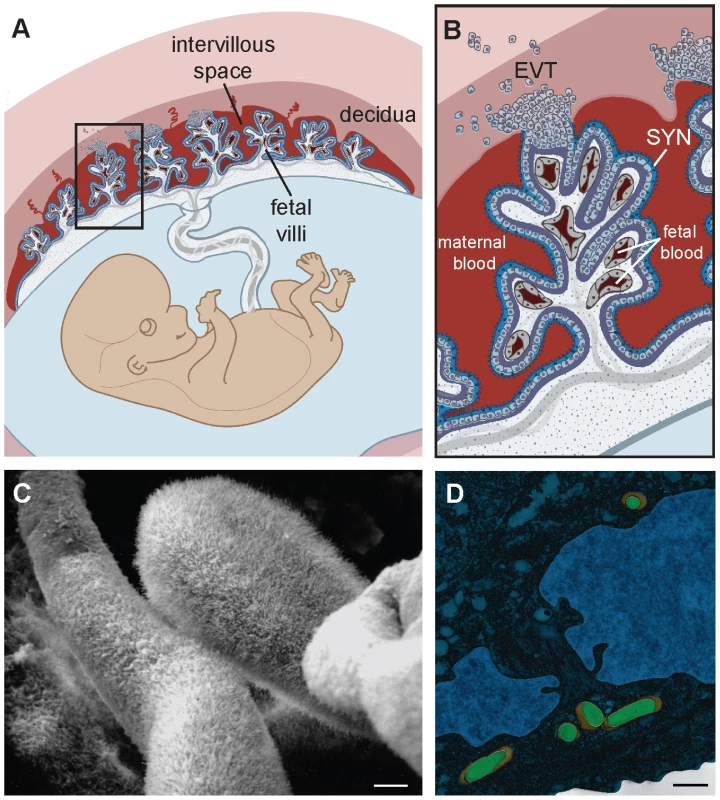 Structure and barriers of the human maternal-fetal interface.
