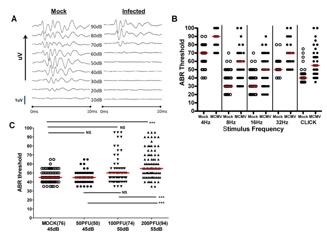Auditory brainstem evoked response (ABR) testing in infected mice.