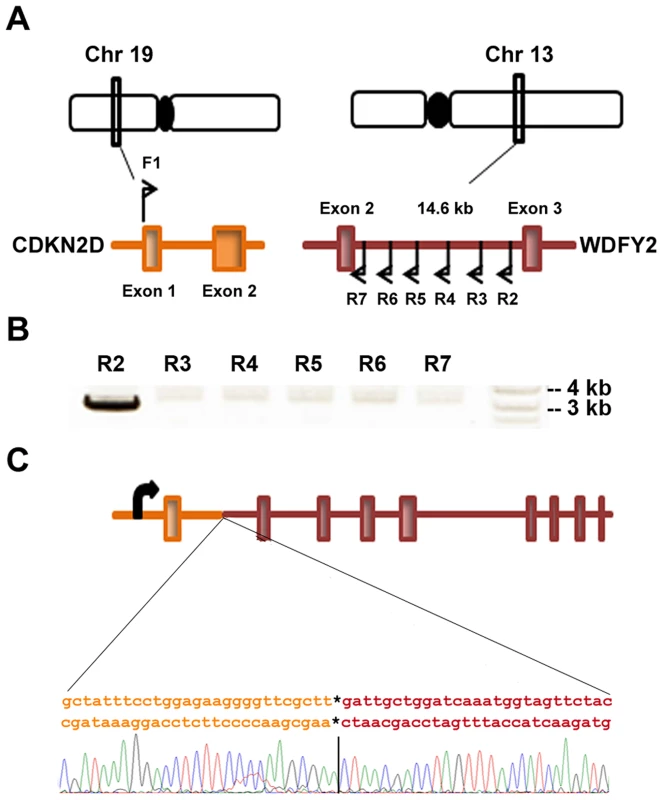 <i>CDKN2D-WDFY2</i> fusion transcript results from a genomic rearrangement of chromosome 19 and 13.