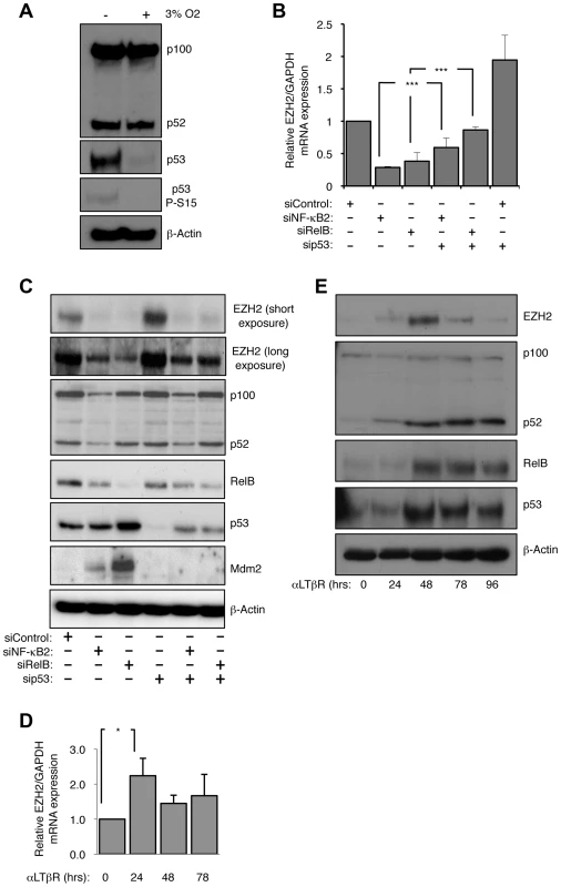 EZH2 is an NF-κB regulated target gene.