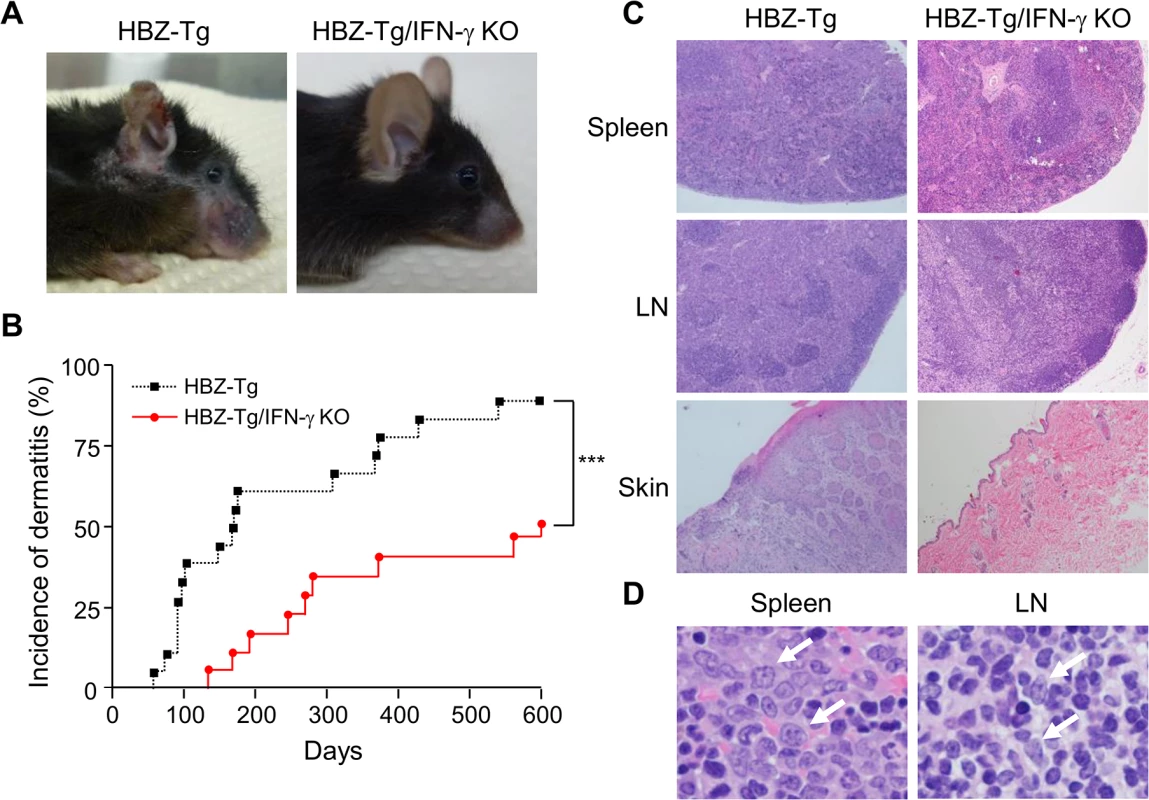 Incidence of inflammation and lymphoma is decreased in HBZ-Tg/IFN-γ KO mice.