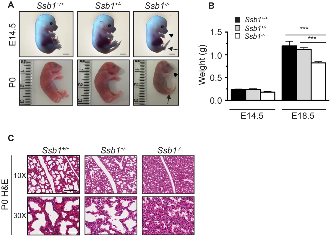 <i>Ssb1</i> deletion causes perinatal lethality due to severe respiratory failure.