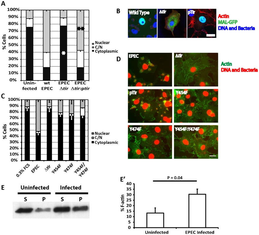 Tir is essential for EPEC induced MAL-GFP translocation.