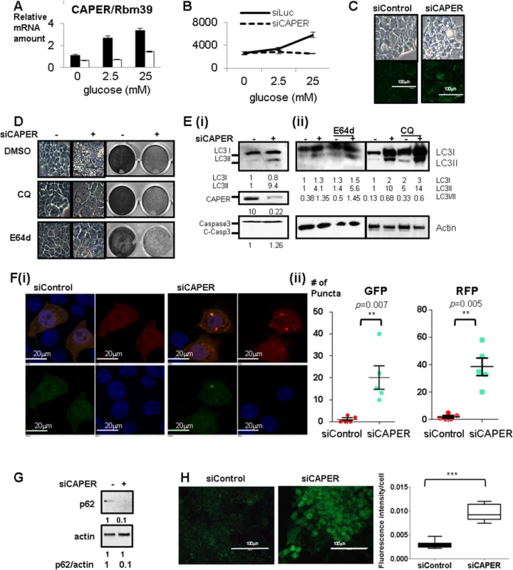 Inhibition of glucose-dependent increased CAPER protein expression suppresses cell proliferation and induces autophagy-mediated vacuolization.