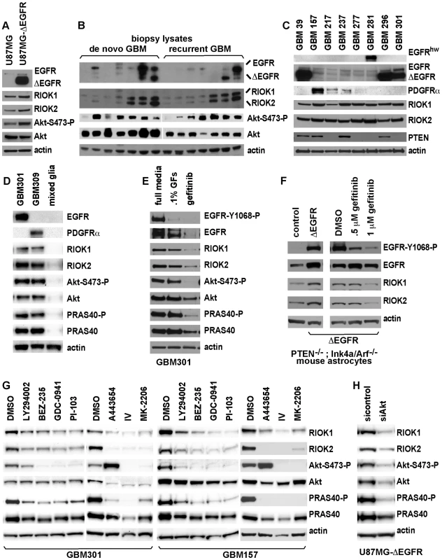 Expression of RIO kinases is associated with EGFR and Akt activity in GBM cells.