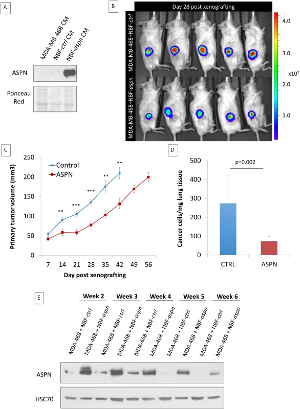 Co-injection of cancer cells and fibroblasts overexpressing asporin reduces primary breast cancer tumor growth and lung metastasis formation in vivo.