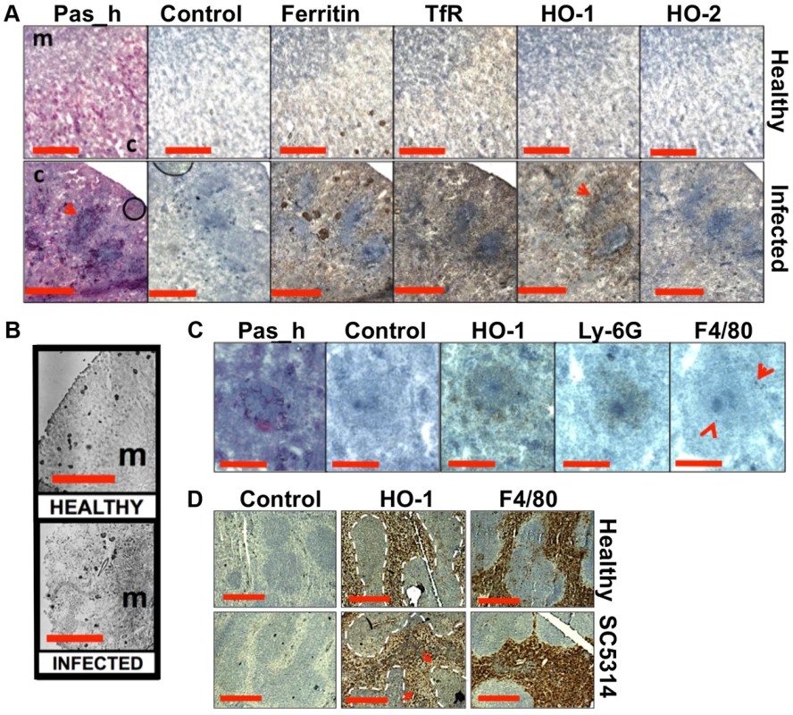 Systemic candidiasis disturbs host renal iron homeostasis and affects splenic function.
