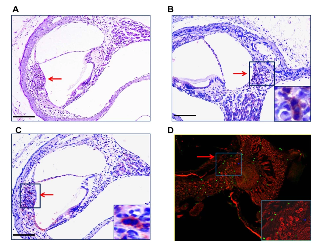 Mononuclear cells infiltrates in the cochlea of infected mice.