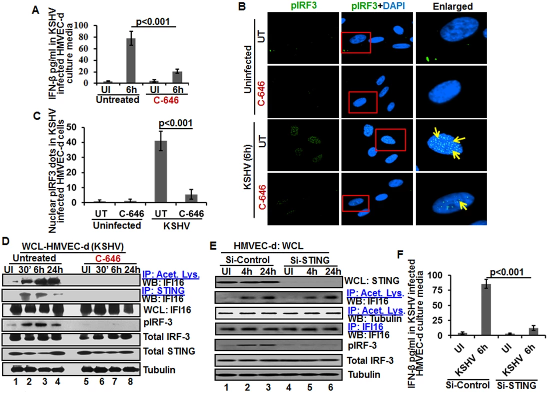 Effect of IFI16 acetylation on IFN-β production during <i>de novo</i> KSHV infection of HMVEC-d cells.