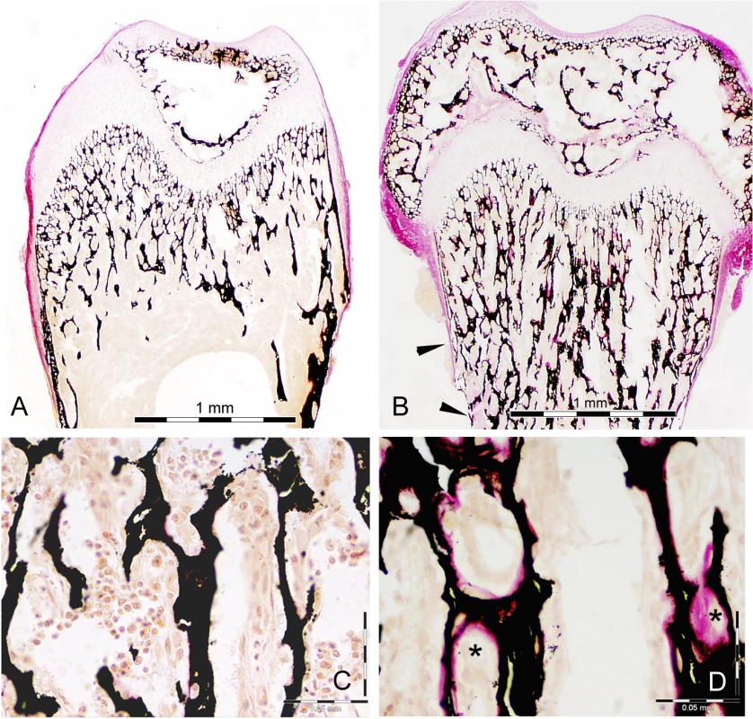 Histology of bone from WT and Snx10 KD mice.