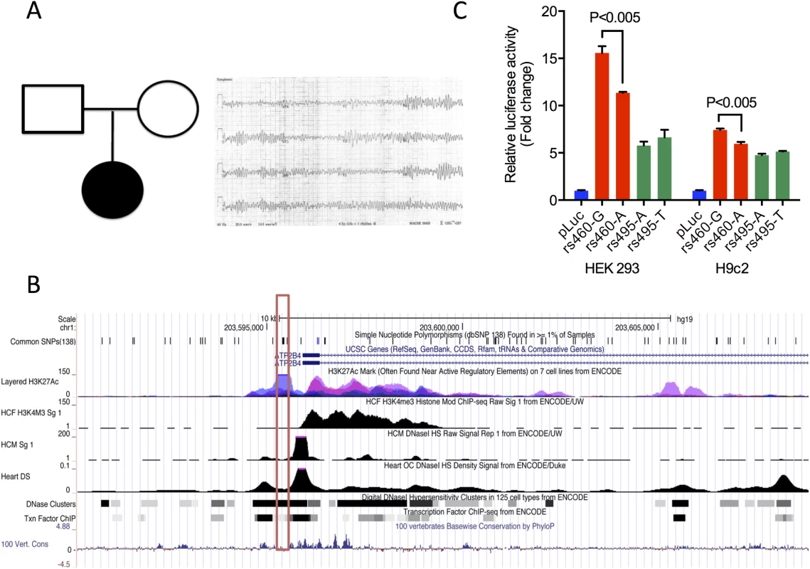 STMP identifies a likely functional regulatory variant in a novel candidate disease gene for neonatal ventricular arrhythmia.