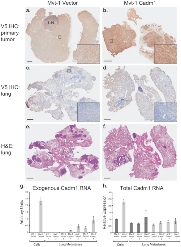 Pulmonary metastases of Mvt-1/<i>Cadm1</i> cells express attenuated levels of <i>Cadm1</i>.