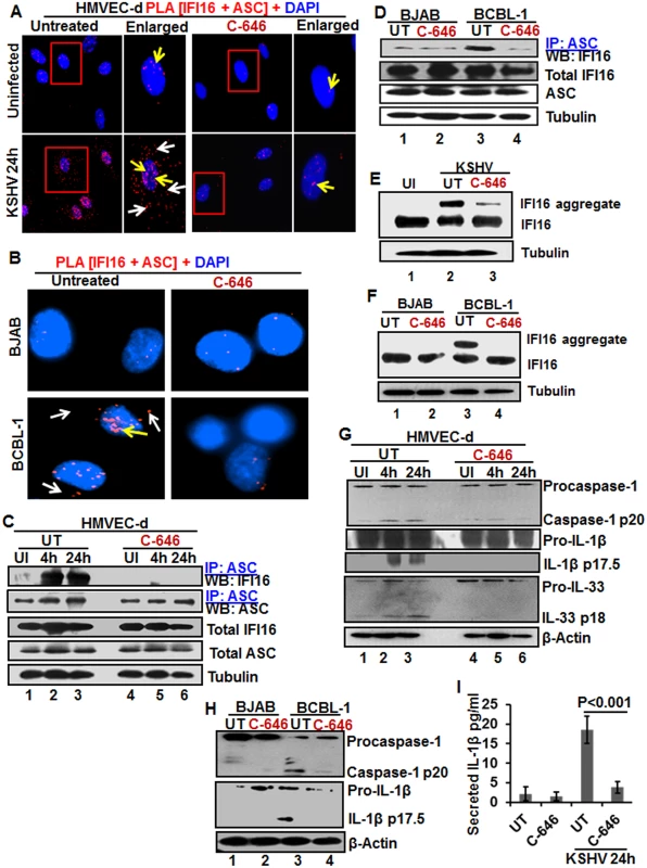 IFI16-ASC inflammasome formation, IFI16 aggregation and consequences during <i>de novo</i> KSHV infection in the presence of C-646.