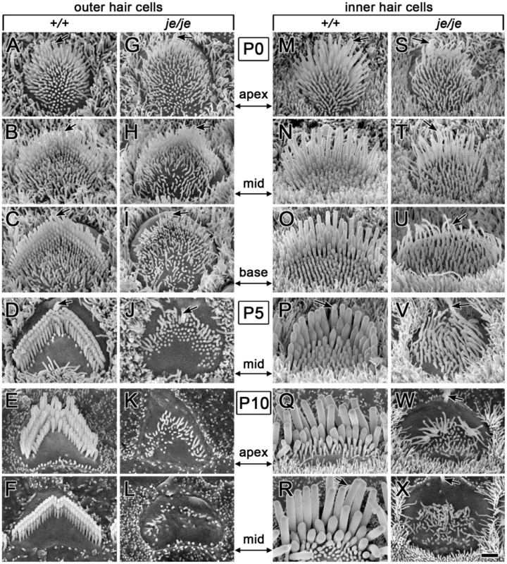 Morphogenesis defects and degeneration of cochlear hair cell stereocilia in <i>je/je</i> mice.