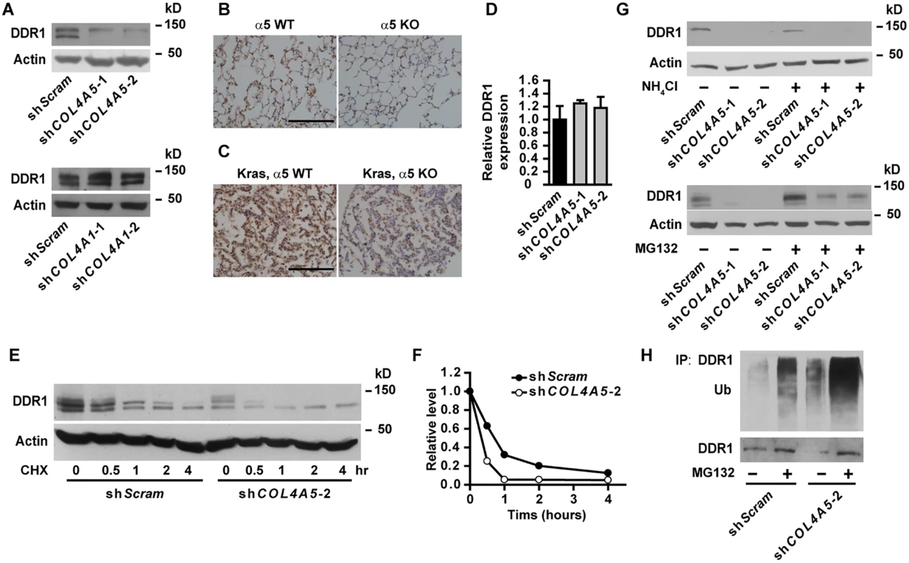 DDR1 is downregulated in α5(IV)-knockdown cells.