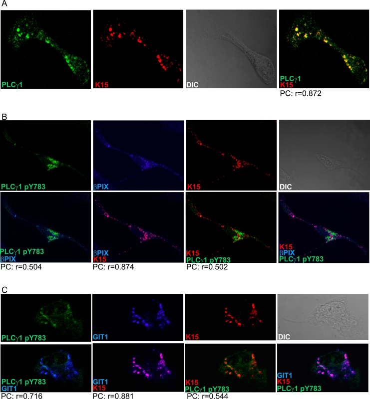 K15, PLCγ1, βPIX and GIT1 co-localize in latent KSHV infected endothelial cells.