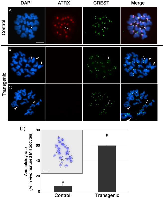 Abnormal chromosome condensation and high incidence of aneuploidy in ATRX deficient oocytes.