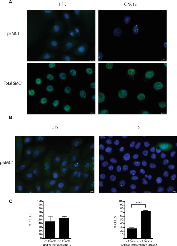 pSMC1 is localized to nuclear foci in HPV positive cells that become more numerous upon differentiation.