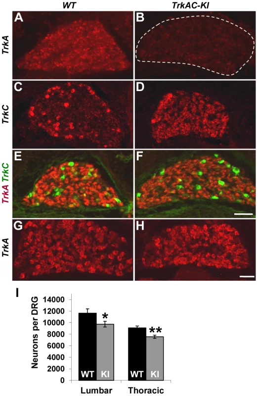 Replacing <i>TrkA</i> with <i>TrkAC</i> is compatible with grossly normal survival of sensory neurons in <i>TrkAC-KI</i> mice.