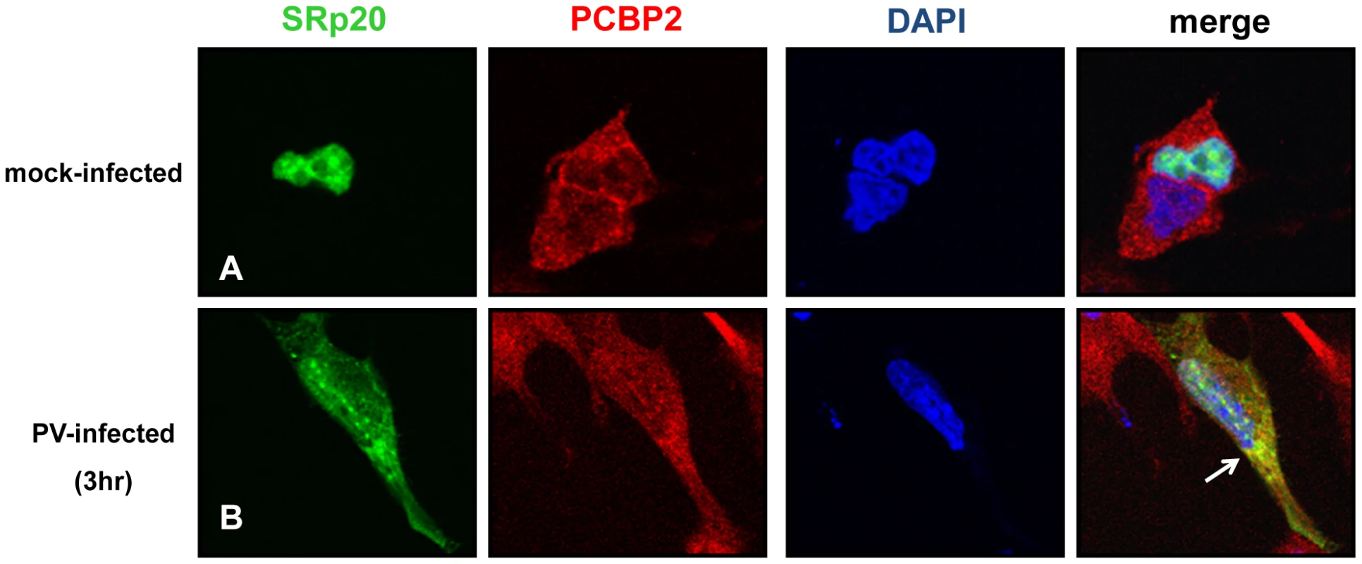 SRp20 partial co-localization with PCBP2 in the cytoplasm of poliovirus-infected SK-N-SH cells.