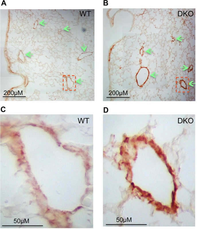 Upregulation of COL1A1 in distal vasculature of miR-29 DKO lungs.