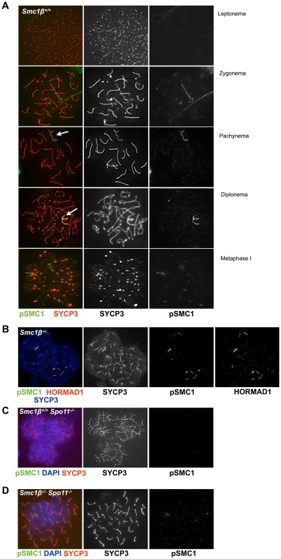 Phosphorylated SMC1α distinctly localizes to asynaptic regions in wt, <i>Smc1β<sup>−/−</sup></i>, and <i>Smc1β<sup>−/−</sup>Spo11<sup>−/−</sup></i> spermatocytes.