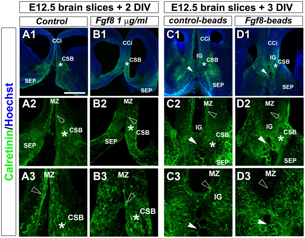 Fgf8 ectopic expression causes severe guidepost neurons mislocalization at the midline.