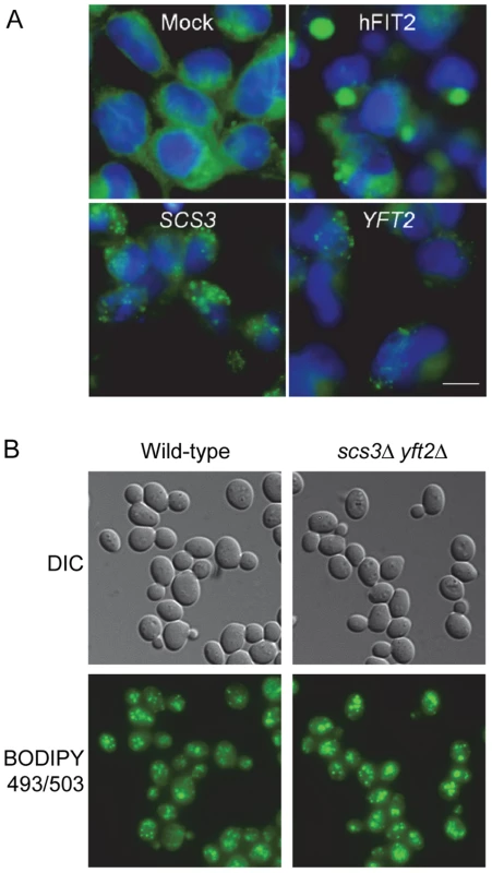 Lipid droplets in human cells expressing <i>SCS3</i> and <i>YFT2</i> and in yeast gene-deletion strains.