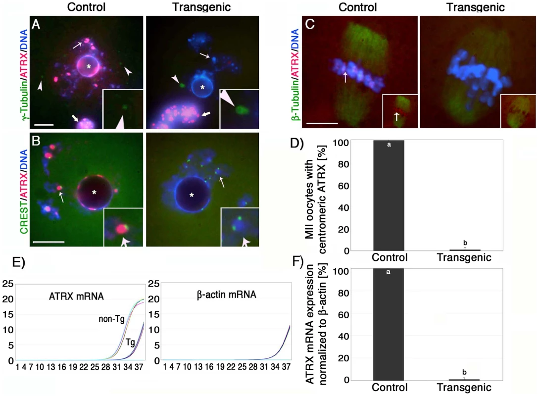 Oocyte-specific ablation of the ATRX protein in a transgenic RNAi mouse model.