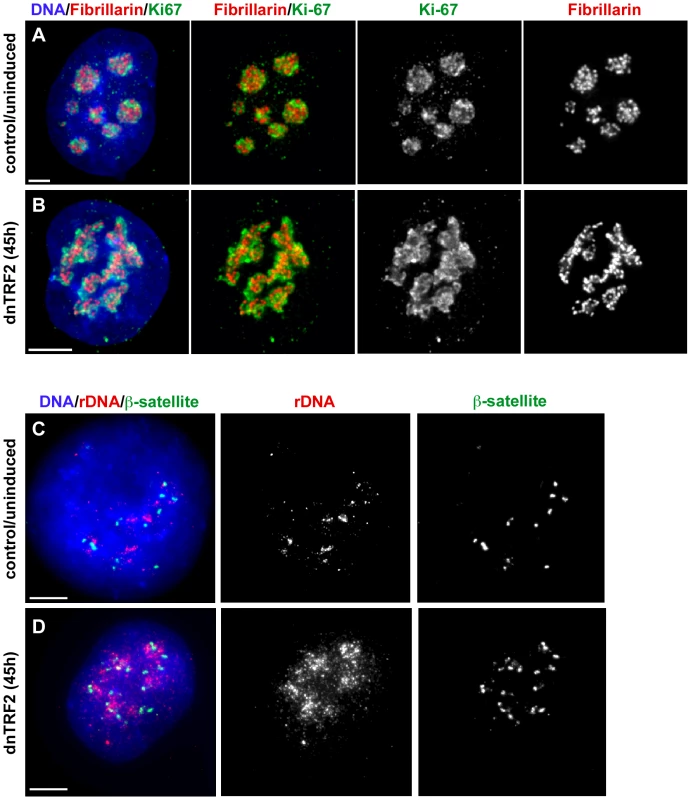 dnTRF2 expression alters nucleolar and acrocentric short arm architecture.