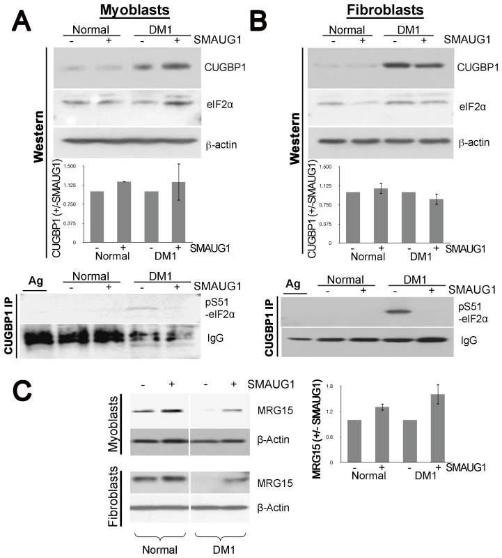 SMAUG1 reduces inactive CUGBP1/pS51-eIF2α translational complexes and recuperates normal levels of MRG15 protein in DM1 myoblasts and fibroblasts.
