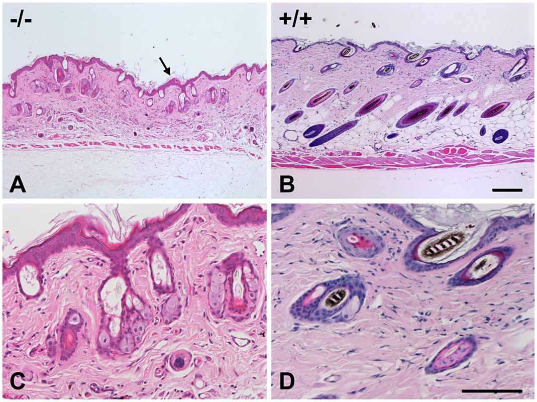 Skin histopathology of the affected mice.
