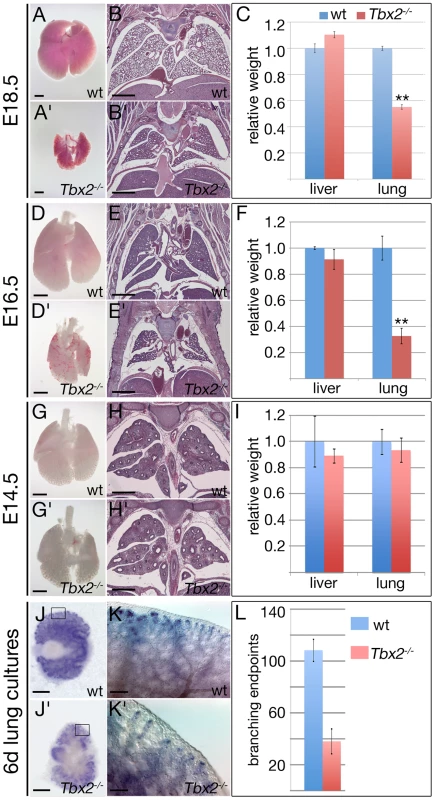 <i>Tbx2</i>-deficient lungs become hypoplastic at the late pseudoglandular stage.