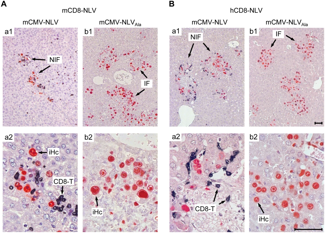 Protective NIF formation after adoptive transfer of NLV-specific murine and human CD8 T cells.