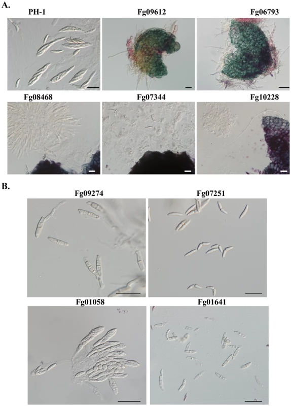 Protein kinase mutants with defects in sexual reproduction.