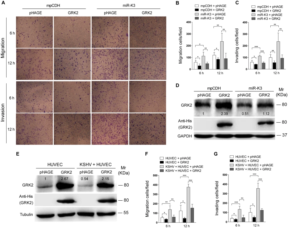 Ectopic expression of GRK2 inhibits miR-K3-induced endothelial cell migration and invasion.