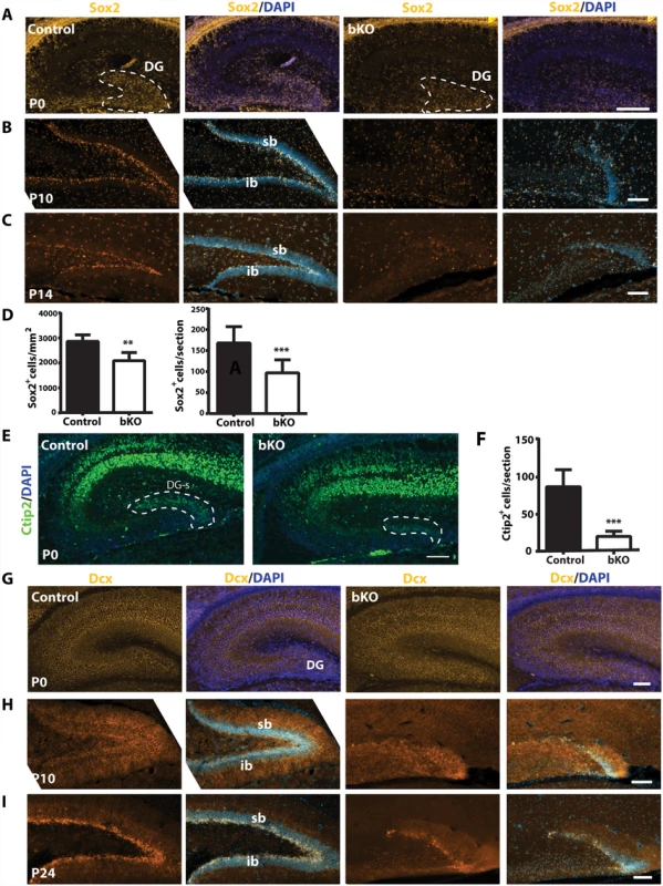 Brpf1 loss compromises neural stem cells and neuronal precursors.