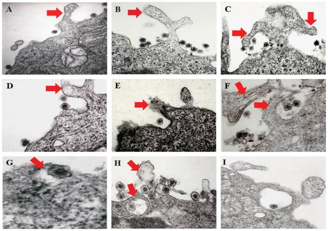 Transmission electron microscopic observation of HMVEC-d cells early during KSHV infection.