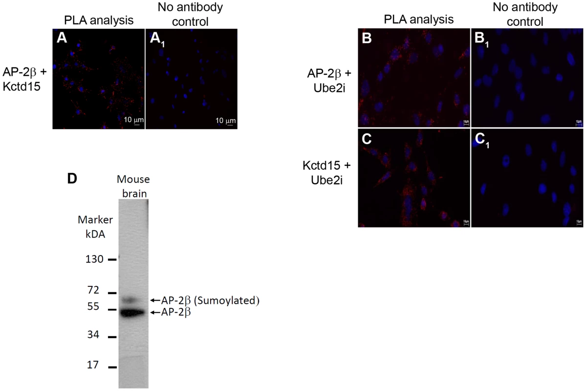 Detection of AP-2β and Kctd15 interactions in mHypoE-N25/2 cells using PLA.