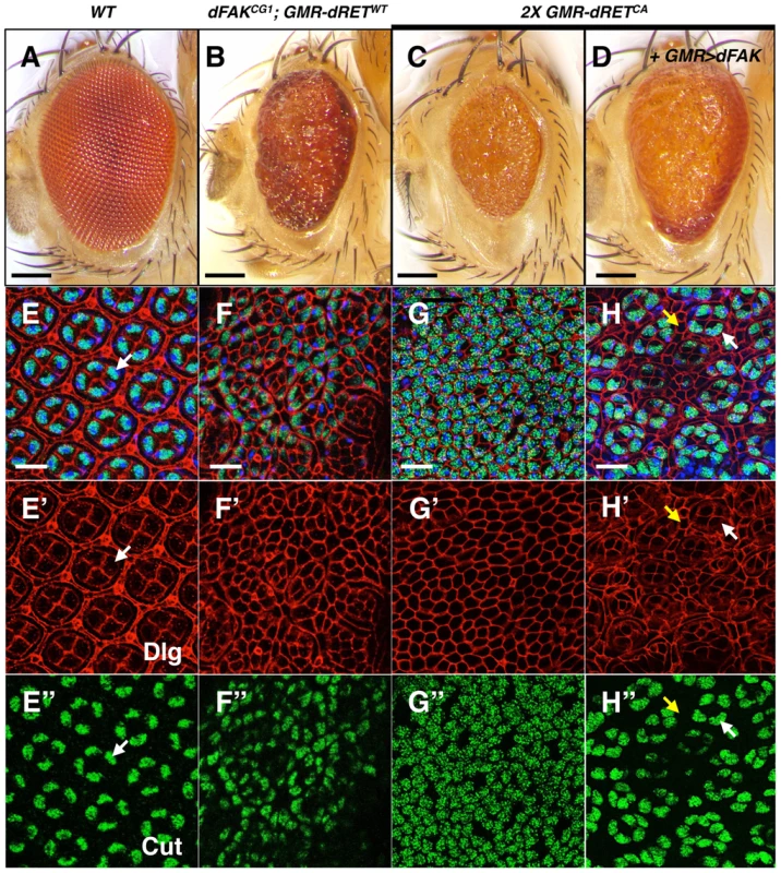 High relative levels between RET and FAK induce ectopic cone cell differentiation in the eye.