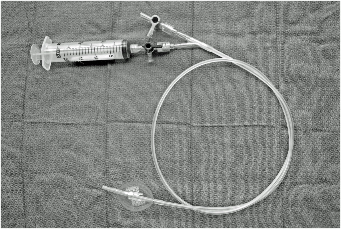 SAAP catheter (photograph by EGB Barnard).
