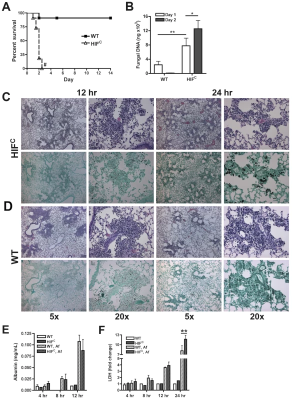Myeloid HIF1α is required for fungal clearance and survival following <i>A. fumigatus</i> pulmonary challenge.