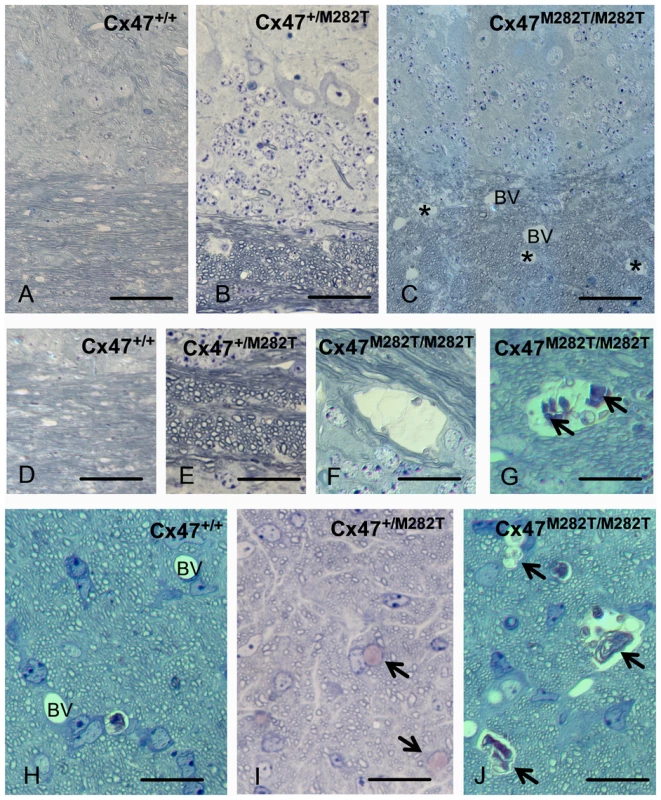 Toluidine blue/pyronin g stained semi-thin sections reveal cystic spaces in white matter of <i>Cx47<sup>M282T/M282T</sup></i> mice.