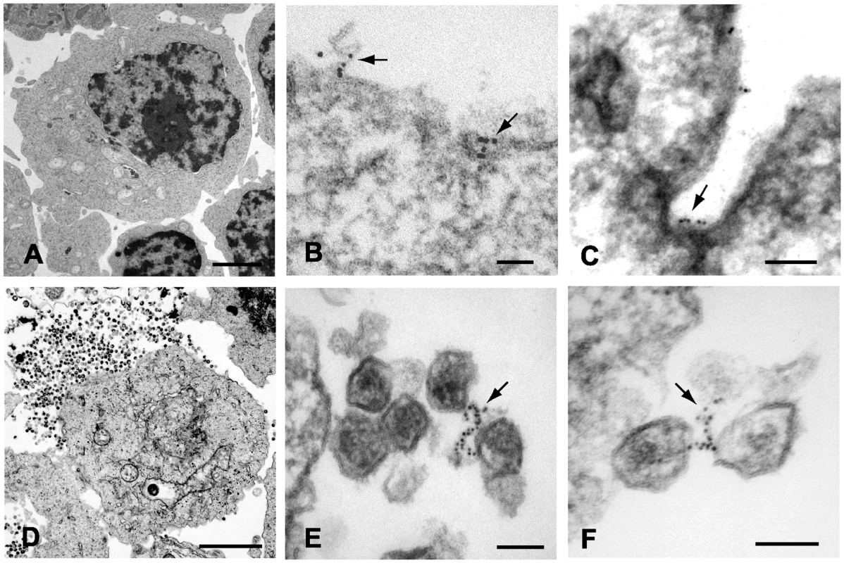 Immunoelectron micrographic analysis of tetherin on IFN-α stimulated A3.01 control cells and samples infected with pseudotyped NL4.3/Udel.