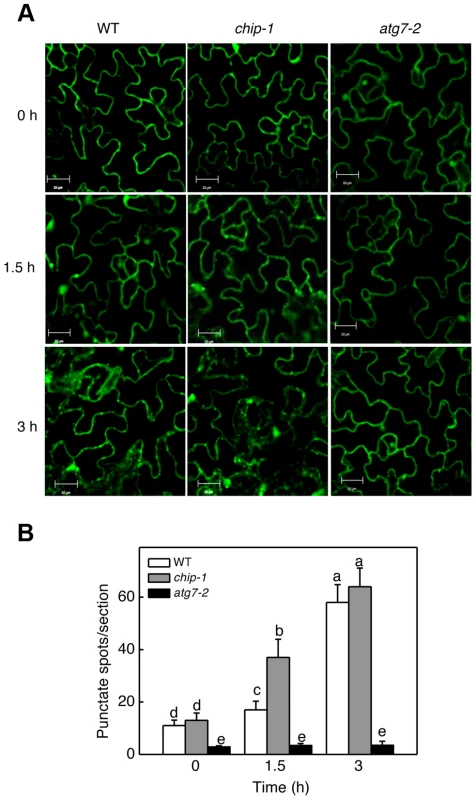 Determination of accumulation of autophagosomes using GFP-ATG8a.