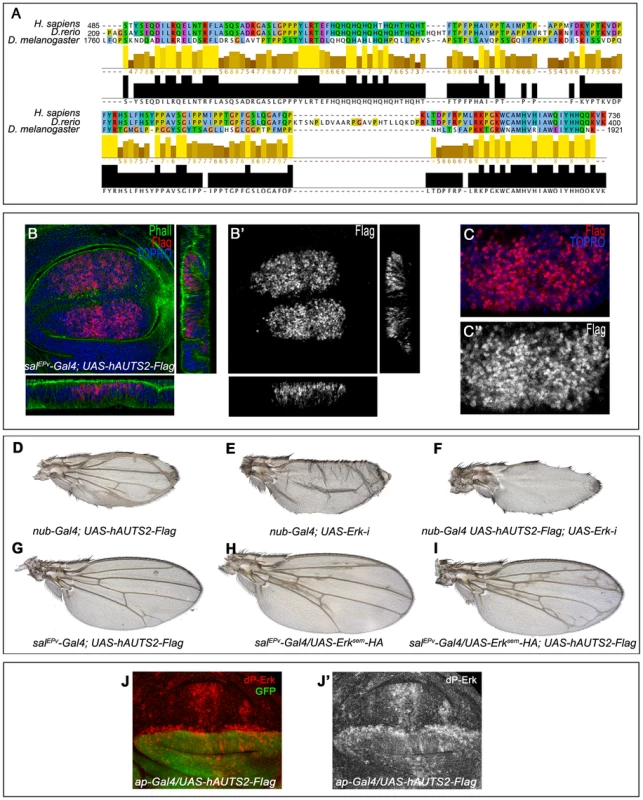 Subcelullar localization and phenotypes of human AUTS2 in flies.