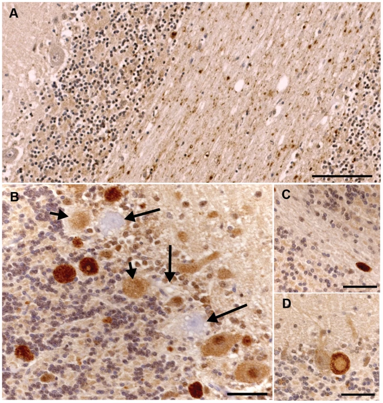 Ubiquitin immunohistochemical staining of the cerebellum of an unaffected 11-year-old Dachshund and an affected 2.5-year-old Gordon Setter.
