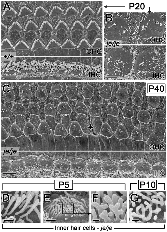 Advanced stereociliary degeneration on cochlear hair cells and peculiar stereociliary defects on inner hair cells.