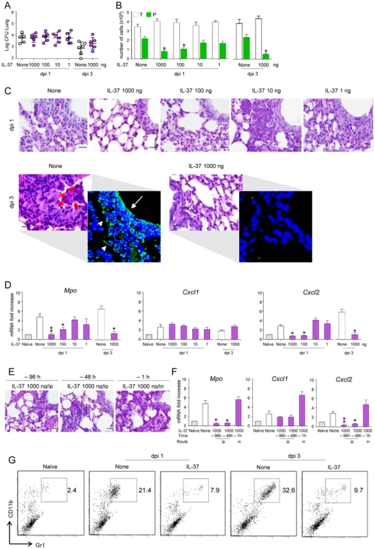 IL-37 reduces inflammatory cell recruitment in mice with inflammatory aspergillosis.